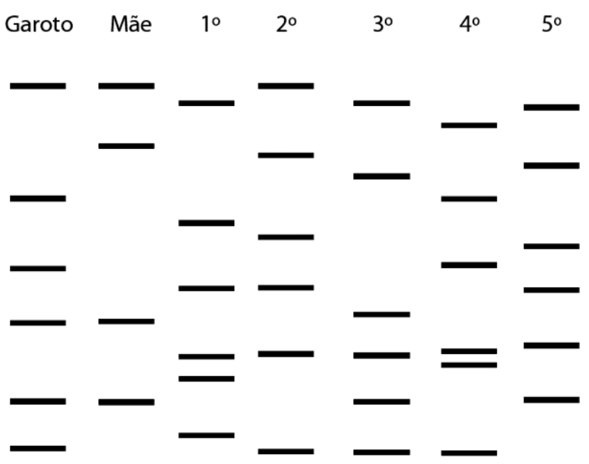 Bandas de DNA do garoto, mãe e cinco voluntários.
