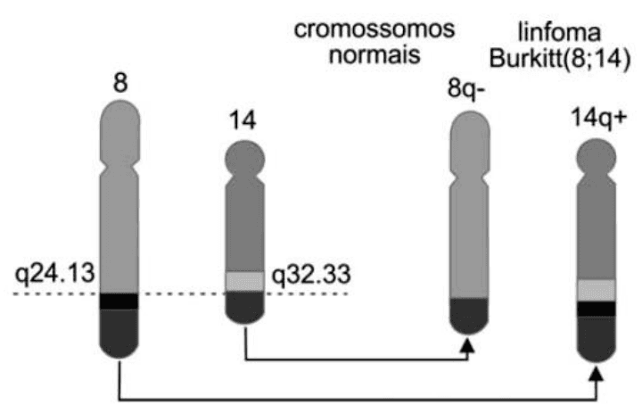 Cromossomos normais 8 e 14, q24.13 e q32.33, e linfoma Burkitt(8;14), 8q- e 14q+, com setas indicativas da troca de segmentos.