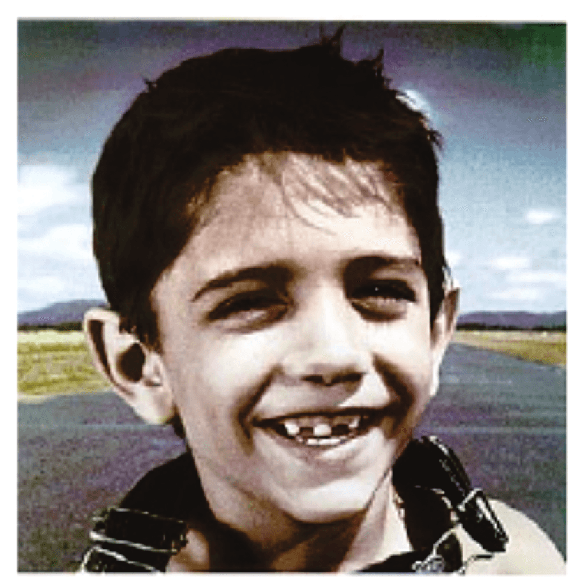 Fotografia do anúncio da Iberia: menino sorridente com intervalo entre os dentes da frente.