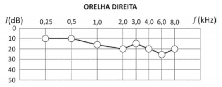 Audiometria da orelha direita: intensidade mínima I em dB versus frequência f em kHz.