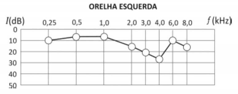 Audiometria da orelha esquerda: intensidade mínima I em dB versus frequência f em kHz.