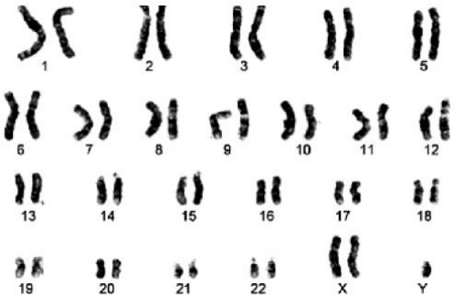 Alternativa b: cariótipo com pares numerados 1–22 e cromossomos sexuais X e Y.