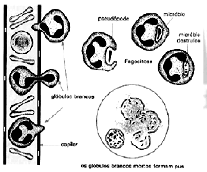 Saída de glóbulos brancos do capilar, fagocitose e formação de pus. Recurso diapedese.