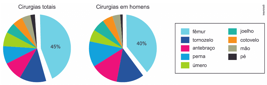 Cirurgias totais e cirurgias em homens, fêmur45% e40%; nove cores e rótulos da legenda.